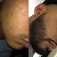 اقدام مساوی نتیجه‌گیری