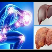 درمان قطعی کبد چرب و کنترل دیابت