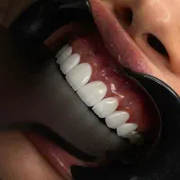 مدل کامپوزیت