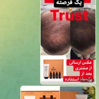 فروش محصوات مراقبتی درخانه