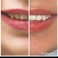 ارتودنسی لبخندی زیبا(فقط تا آخر ماه)|خدمات آرایشگری و زیبایی|مشهد, آزادشهر|دیوار