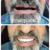 انواع‌ دندان متحرک حرفه ای طرح لمینیت و... باضمانت|خدمات آرایشگری و زیبایی|تهران, ائمه اطهار|دیوار