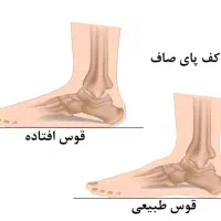 کلینیک تخصصی درمان کف پای صاف