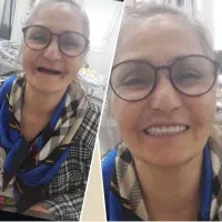 ساخت پروتز متحرک|آرایشی، بهداشتی، درمانی|آمل, |دیوار