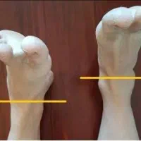 آزادسازی درد سیاتیک واصلاح آن|خدمات آرایشگری و زیبایی|قم, زنبیل آباد|دیوار