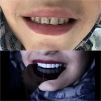تغییر چهره با لبخندی نو