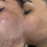 آموزش فیشال مبتدی و پیشرفته|خدمات آموزشی|آبادان, |دیوار