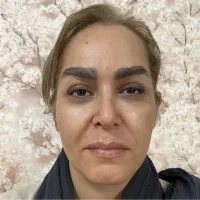 فیلر بوتاکس جوانساز جراحی بادی نخ مزو هیرفیلر|خدمات آرایشگری و زیبایی|تهران, پاسداران|دیوار