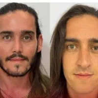 عمل بینی لیزری/بدون‌کبودی بدون‌ دردبیسودجراح معروف|خدمات آرایشگری و زیبایی|شیراز, قصرالدشت|دیوار