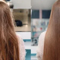 مدل بوتاکس یا پلکس تراپی
