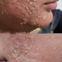 آلگاپیل،فیشال (خانمها و آقایان)|خدمات آرایشگری و زیبایی|یاسوج, |دیوار