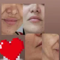 دوست داری پوستت را ۱۰ سال جوانتر کنی