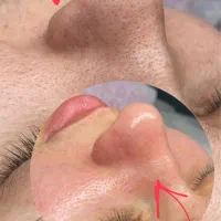 تخفیف شب یلدا فیشال و پاکسازی صورت و پذیرش هنرجو|خدمات آرایشگری و زیبایی|تهران, نیروی هوایی (پیروزی)|دیوار