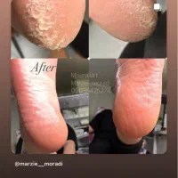 آموزش پدیکور و پارافین تراپی و ارتونیل|خدمات آموزشی|اصفهان, مرداویج|دیوار