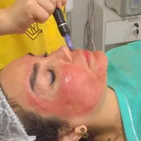 خدمات پاکسازی پوست و فیشال خانم ها و آقایان|خدمات آرایشگری و زیبایی|مشهد, شهید فرامرز عباسی|دیوار