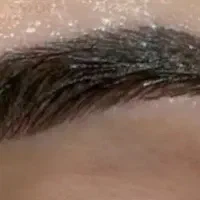 / کاشت مو و ابرو /بلفارو/ /عمل بینی ژل وبوتاکس|خدمات آرایشگری و زیبایی|تهران, دکتر هوشیار|دیوار