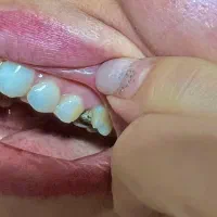 دستیار دندانپزشک