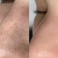 خدمات فشیال تخصصی