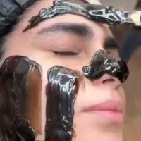 تخفیف ویژه اپیلاسیون ووکس صورت