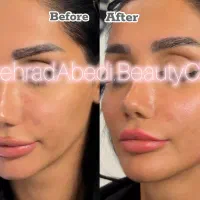 کلینیک زیبایی دکتر بهـراد عابدی