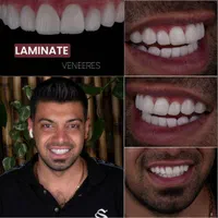 بزرگترین جشنواره تخفیفات دندانپزشکی برای نخستین با