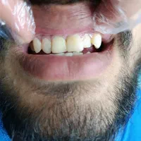 دندانپزشکی در خرم آباد با تخفیف ویژه|خدمات آرایشگری و زیبایی|دورود, |دیوار