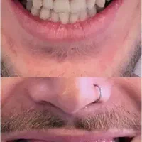 جشنواره کامپوزیت،لمینیت وبلیچینگ وخدمات دندانپزشکی|خدمات آرایشگری و زیبایی|شاهین‌شهر, مخابرات (شهید بهشتی)|دیوار