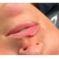 تزریقات زیبایی|خدمات آرایشگری و زیبایی|قرچک, مهدیه|دیوار