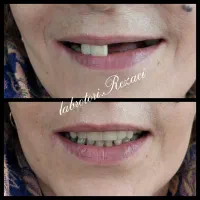 ساخت و تعمیر دندان متحرک|خدمات آرایشگری و زیبایی|شیراز, دکتر حسابی|دیوار