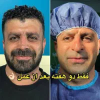 عمل بینی  عمل دماغ شمال