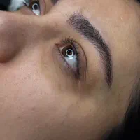 میکرو بلیدینگ