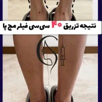 فیلرباسن هیپ دیپ ۱۲۰سیسی ۱۲میلیون تا آخر مهر|آرایشی، بهداشتی، درمانی|تبریز, |دیوار