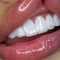 کامپوزیت لبه شیشه ای با این قیمت جایی پیدا نمیکنی|خدمات زیبایی و سلامت|تهران, فردوس|دیوار