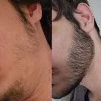 سلطان جنگل به شیرشه پسر ایرانی به ریششه