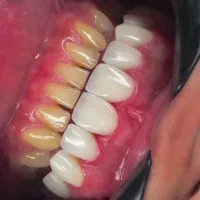 فقط با  پنج میلیون کامپوزیت کن|خدمات آرایشگری و زیبایی|تهران, سهروردی|دیوار