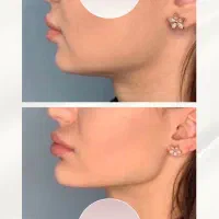 مرکز تخصصی زیبایی نکوئین
