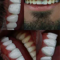 تخفیف ویژه لمینت و کا،مپوزیت تا ۵ اردیبهشت