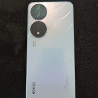 آنر x7b