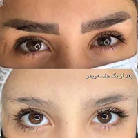 مدل برای میکروبلیدینگ و آرایش دائم صورت و ریموو|خدمات آرایشگری و زیبایی|مشهد, هنرستان|دیوار