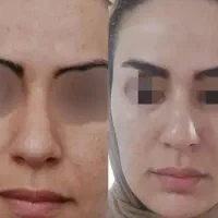 با مشکلات پوستیت خداحافظی کن