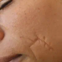 برداشتن لک و کک و مک|خدمات آرایشگری و زیبایی|نورآباد, |دیوار