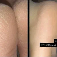 پارافین تراپی وپدیکوروکفسابی پاویژه آقایون وبانوان|خدمات آرایشگری و زیبایی|اصفهان, چشمه باقرخان|دیوار