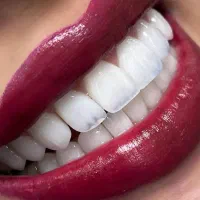 دستبار دندانپزشک