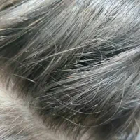 پاکسازی شپش فقط تویه جلسه