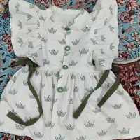 لباس دختر بچه