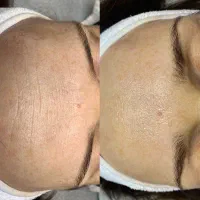 مرکز تخصصی پاکسازی صورت|خدمات آرایشگری و زیبایی|جم, |دیوار