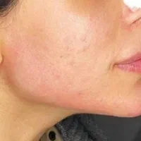ژل،بوتاکس،فیبروز،رژ دایم،اکستنشن مژه سالن ومنزلتون|خدمات آرایشگری و زیبایی|شیراز, مسلم|دیوار