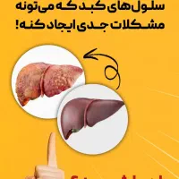 درمان خانگی کبد چرب|آرایشی، بهداشتی، درمانی|سیرجان, |دیوار
