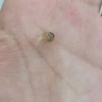 جوجه حلزون