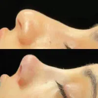 جراحی بینی دکتر پریاوی 37 تومان|خدمات آرایشگری و زیبایی|شیراز, آبیاری|دیوار